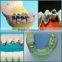 Mini 100wlaser welding machine for Dental industry with internal water cooling system