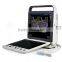 MC-DU-S9 Excellent Superb Portable Color Doppler 3D 4D Ultrasound Machine