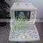 MY-A001 GE cable connect clear image type USB convex probe full digital ultrasound scanner