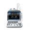 Portable medical black and white ultrasound machine Full digital diagnostic ultrasound