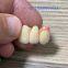 China Screw Implant Crown And Cridge Manufacturers Factory Suppliers