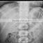 Xray film 14*17inch blue based China Manufacture