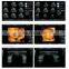MY-A031B High definition LED monitor Digital Color Doppler Ultrasound System(3D/4D)