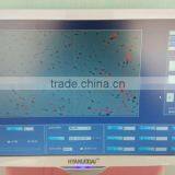 Beautiful Sperm Analysis System Analysis of Sperm Quality thumbnail-6