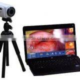 Digital Video Colposcope, Laptop Video Colposcope, Gynecology Video Colposcope thumbnail-4