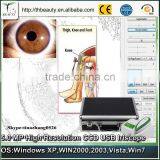 Factory Price Body Health Analysis by USB Eye Iris Scanner thumbnail-5