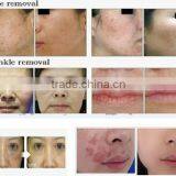 Best Low Price Co2 Laser Machine, Professional Low Price Co2 Laser Machine thumbnail-6