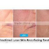 High Power 50w Co2 Laser Engraving and Cutting Machine thumbnail-2