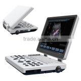 High Quality Ultrasound Machine Price With 128 Element Probes