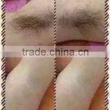 Fast Med Shr Ipl Laser Hair Removal/ Skin Rejuvenation Shr Ipl Elight Machine With CE for Sale thumbnail-6