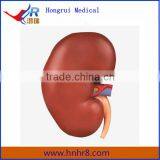 Medical Human Enlarged Kidney Anatomy Model