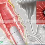 Vaginal Tightening Device Ultrasonic Focusing Technique With Hifu Vagina Treatment thumbnail-6