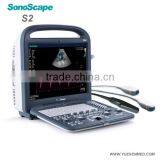 SonoScape 3D 4D Vet Color Doppler Ultrasound Sonoscape S2v thumbnail-6
