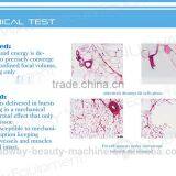 HIFUShape Body Contouring/HIFU Body Shaping/HIFU Fat Reduction System thumbnail-2