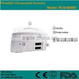 CE Approved Portable B-Mode Ultrasonic/ Ultrasound Scanner With 3.5Mhz Multi-frequency Convex Probe RUS-6000D thumbnail-3