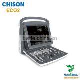 Top Quality Imaging Cheapest BW Chison ECO2 Portable Ultrasound Price
