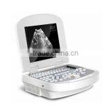 B/W Ultrasound Imaging System Ultrasound Scanner RUS-2000 With CE ISO Approved thumbnail-1