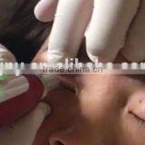 2016 Led Nano Photon Lip/Eyelash/Facial RECHARGEABLE Microneedle Derma Pen thumbnail-4