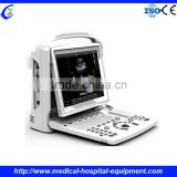 China Portable Ultrasound Machine Price
