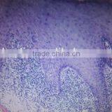 Oral Lichen Planus Oral Medical Pathology Slides