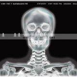 Chinese Manufacturer, Low Price and Good Quality Medical Dry Imaging Film From China Compatible With Fuji and Agfa thumbnail-1