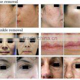 Wrinkle Removal Fractional CO2 Laser With USA RF Tube thumbnail-6