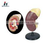 Human Kidney With Adrenal Gland