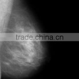 China thermal film KND-A/F CE mamografia