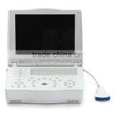 15-inch Laptop Ultrasound Scanner With Multi-frequency Probes thumbnail-2
