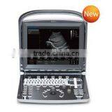 Promotion!!CE Approved Notebook/ Portable Chison USB Ultrasound Scanner With 3.5Mhz Multi-frequency Convex Probe ECO1 thumbnail-1