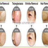 Quality Portable Electronic Hair Remover/ Portable Electronic Spot Remover for Sale thumbnail-4
