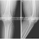 Medical Thermal x Ray Film,croatian Products Health Medical,Pet Clinic,pet Film Thermoforming thumbnail-1