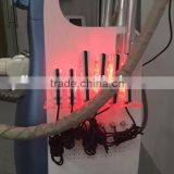 2017 Medical Safe and Comfortable Treatment Cryo 3 Handle , Cryo Fat Freeze Slimming Vacumm Fat Freezing Machine CL2 thumbnail-4