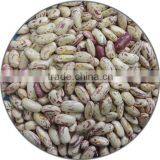 2015 New Crops of Light Speckled Kidney Beans thumbnail-1