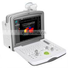 MKR6000 Full Digital Color Doppler Diagnostic System Ultrasound