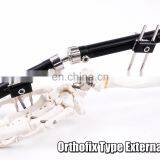 Orthopedic Fixation Ilizarov Ring External Fixator for Tibia &Femur - China  External Fixator, Surgical