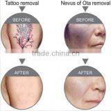 Best China Hot Sale!! Super Fast Color Touch Screen Tattoo Removal Pigmentation Therapy 10HZ thumbnail-6