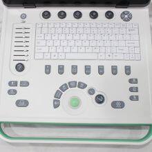 C5Pre Laptop Color Doppler thumbnail-3