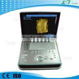 LTS-9 Laptop Portable Ultrasound B Scanner