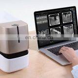 MY-D068-2 Medical Device Rayos x Dental Portatil Portable Intraoral Dental X-ray Film Scanner thumbnail-2