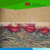 Individual Low Priced Grape Diseases Microscope Glass Slides