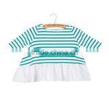 Children Cotton Stripe Printed Baby Ruffle Tops thumbnail-4