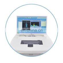 Low Cost Cardiovascular Disease Multi-function General Test Instrument Health Evaluation thumbnail-4