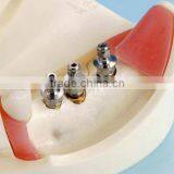 Typodont Orthodontic Model for Practicing Teeth Model Factory thumbnail-2