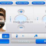 Rejuvi Tattoo Removal Q Naevus Of Ota Removal Switch Nd Yag Carbon Laser Tattoo Removal System thumbnail-5