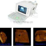 Promotion!!CE Approved Notebook USB Ultrasound Scanner With 3.5Mhz Multi-frequency Convex Probe RUS-6000A thumbnail-2