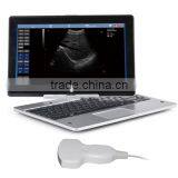 UProbe-20 Probe Type Ultrasound Scanner for Laptop thumbnail-1