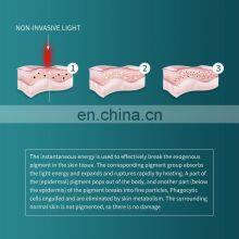 Factory ND Yag Laser Machine Q Switch Non Invasive Laser Instrument Eyebrow Pigment Tattoo Removal Beauty Instrument thumbnail-2