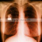 Medical Thermal x Ray Film,medical Thermal Dry Film ,medical Lab Analyzers thumbnail-1