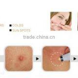 Best Effective Hot Sale Soft Acne Laser Removal/acne Treatments Pen for Sale thumbnail-5